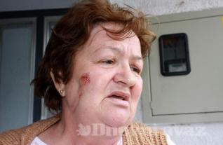 blusrcu.ba-Povratnica Esma Poparić brutalno pretučena debelim kablom
